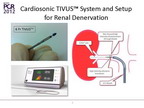 [EuroPCR 2012]Cardiosonic TIVUSTM技术：一种靶向肾脏去神经的血管内超声导管