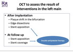 [EuroPCR 2012]中等程度的左主干病变的评估：OCT可提供与IVUS相似的信息